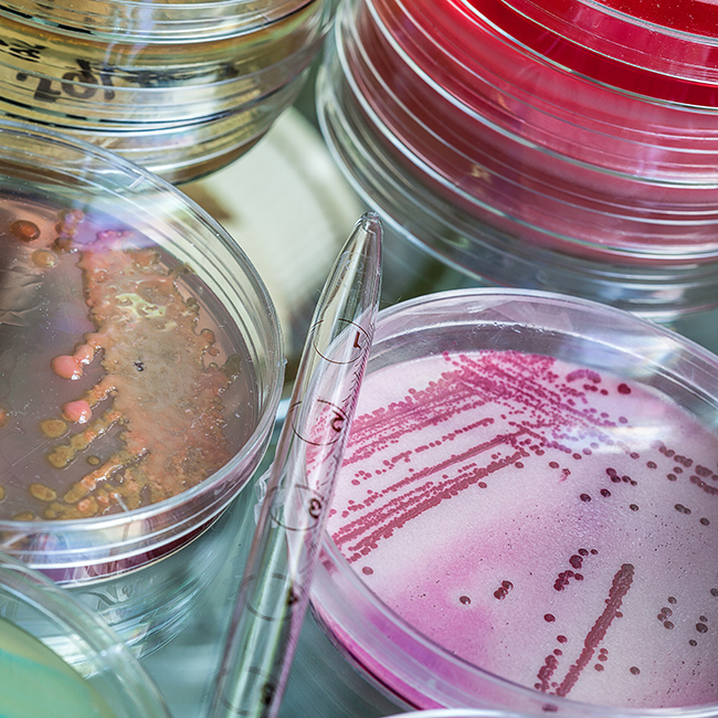 Legionella Legionella