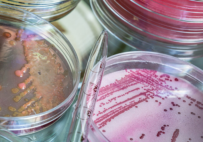 Legionella Legionella